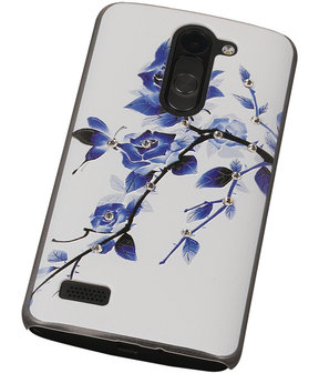 3D Hardcase met Diamant L Bello D335 Blauw Roos