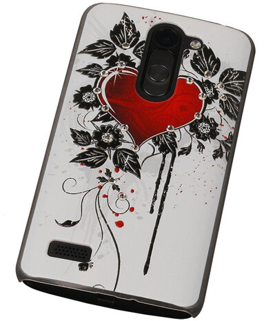 3D Hardcase met Diamant L Bello D335 Hartje